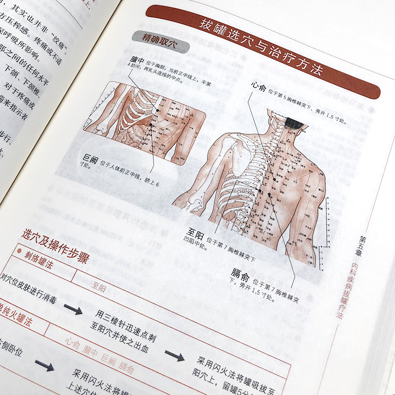 超簡單艾灸拔罐刮痧全書套裝3冊 超簡單艾灸拔罐刮痧全書套裝3冊