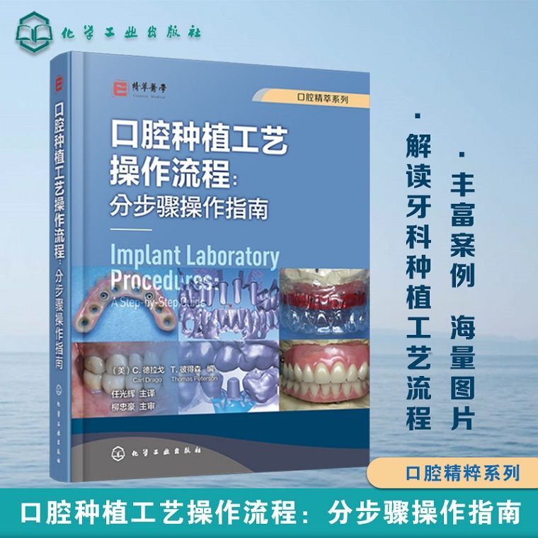 口腔精萃系列--口腔種植工藝操作流程：分步驟操作指南