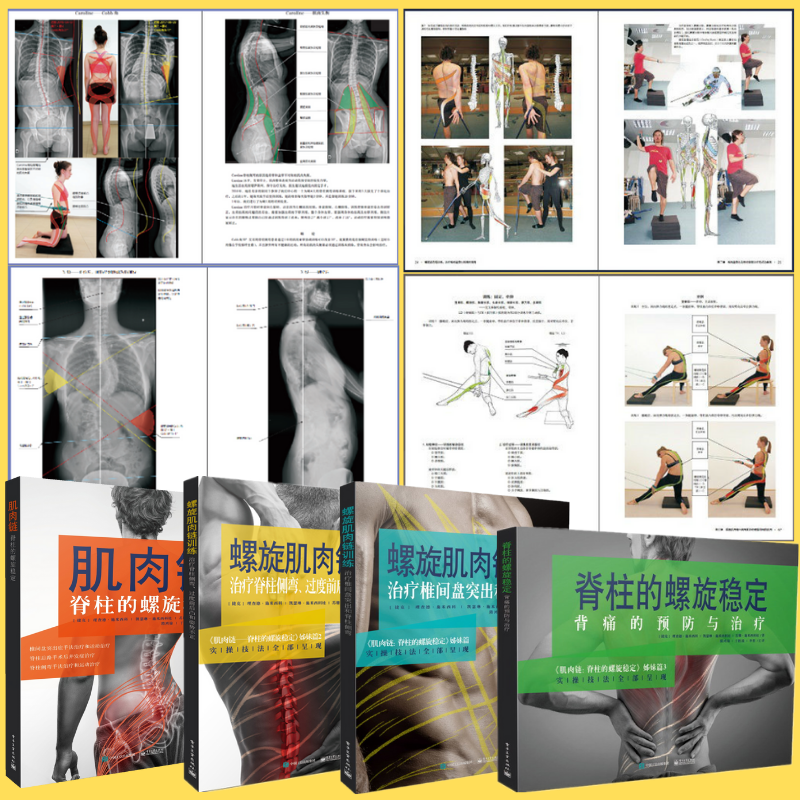 【肌肉鏈脊柱的螺旋穩定】+【肌肉鏈訓練治療椎間盤突出脊柱側彎】+【脊柱側彎過度前後凸和姿勢不正】+【螺旋穩定背痛的預防】
